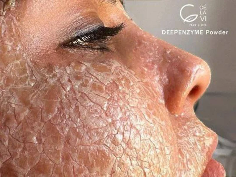 دیپ آنزیم سلاوی
